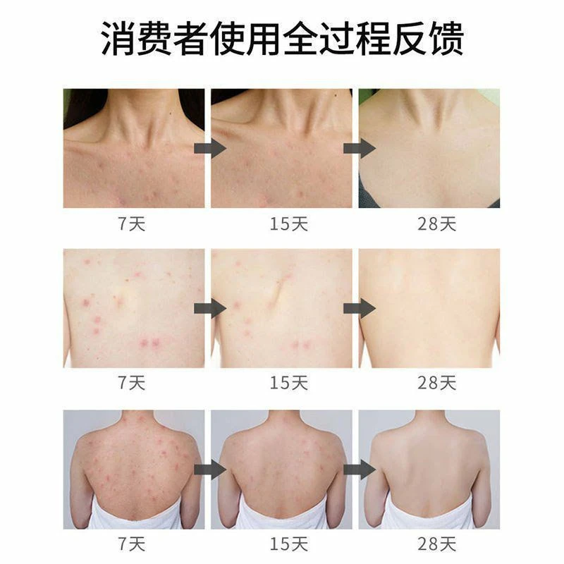 اسپری ضد جوش بدن سیازو رایکو اصلی - Image 2