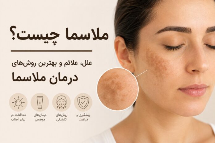 ملاسما
